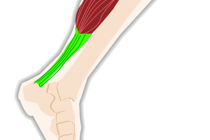 Achilles Tendons & Calf Muscles, FAAWC