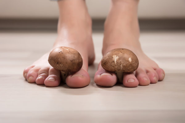 The Best Way to Get Rid of Athlete’s Foot
