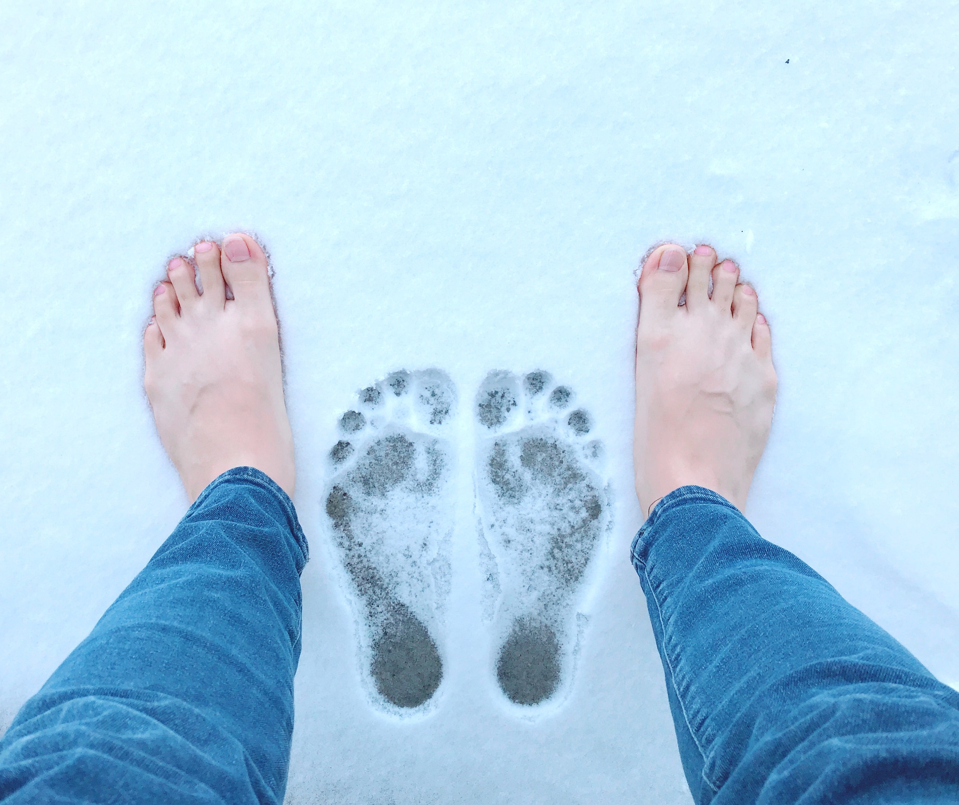 Raynaud’s Disease