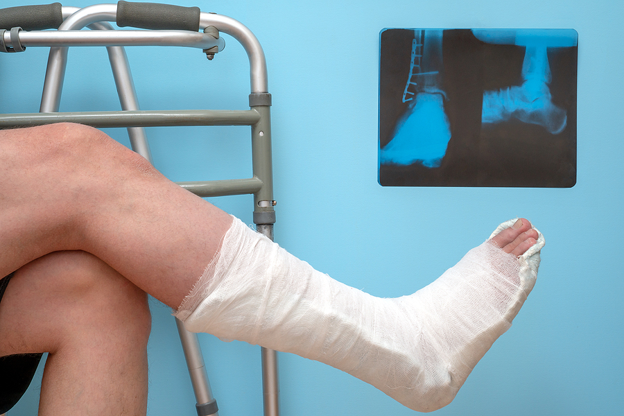 Planning Your Foot & Ankle Surgery