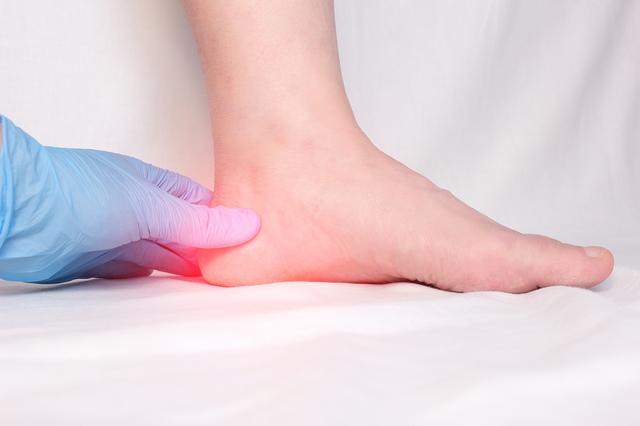 Can I Wait to See My Doctor for Plantar Fasciitis?